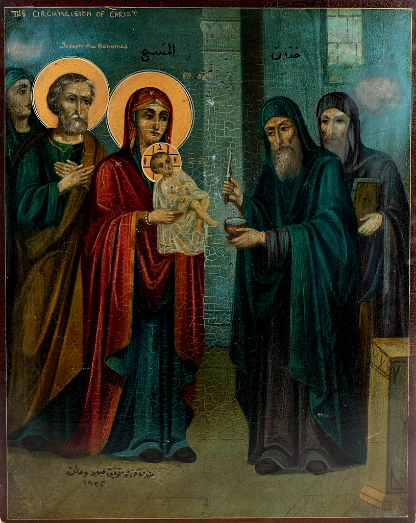 Circuncisão de Jesus